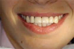 Before: Dramatic Smile Improvement